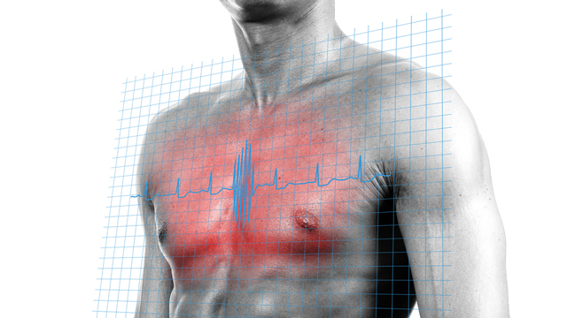 Was bedeutet eigentlich Herzfrequenzvariabilität?