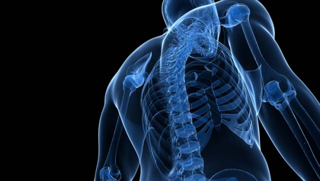 Morbus Bechterew – Ursache, Symptome, Behandlung