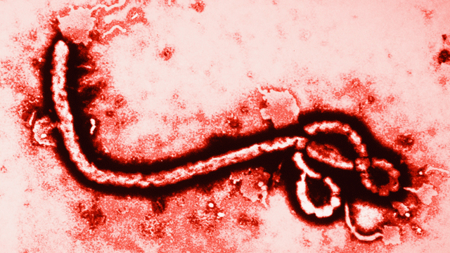 Epidemie - Darum ist Ebola so gefährlich 